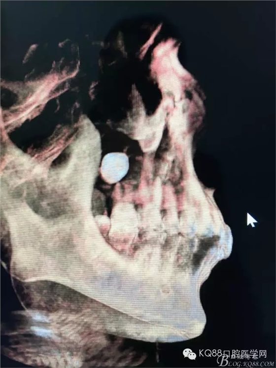 16.webp.jpg 16.webp.jpg