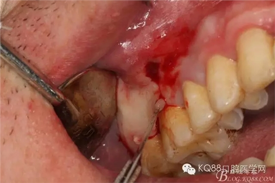 17.webp.jpg 17.webp.jpg