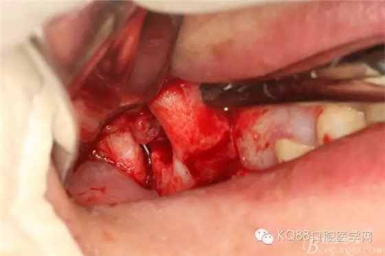 19.webp.jpg 19.webp.jpg