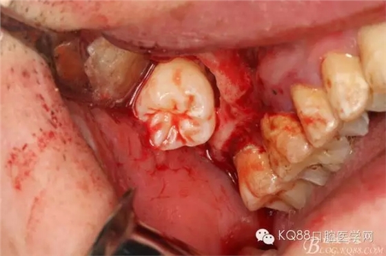 23.webp.jpg 23.webp.jpg