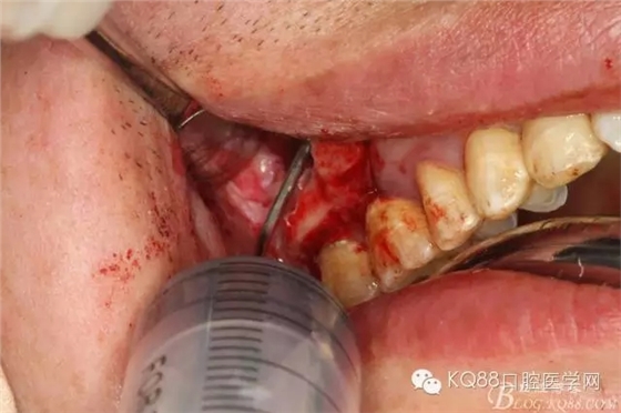 25.webp.jpg 25.webp.jpg