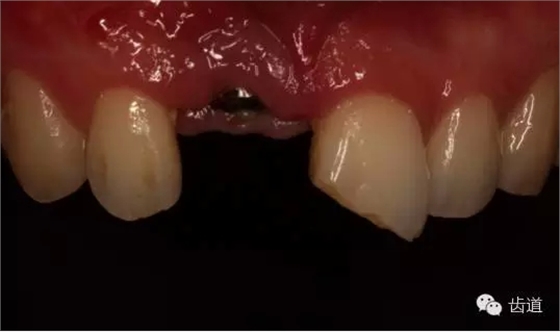 9.webp.jpg 9.webp.jpg