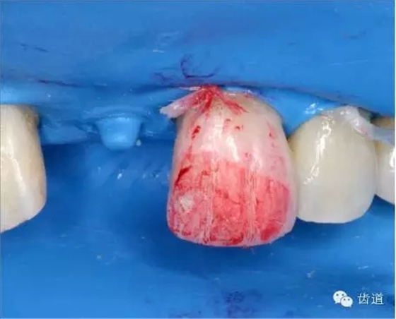 31.webp.jpg 31.webp.jpg