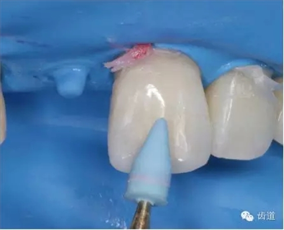 33.webp.jpg 33.webp.jpg