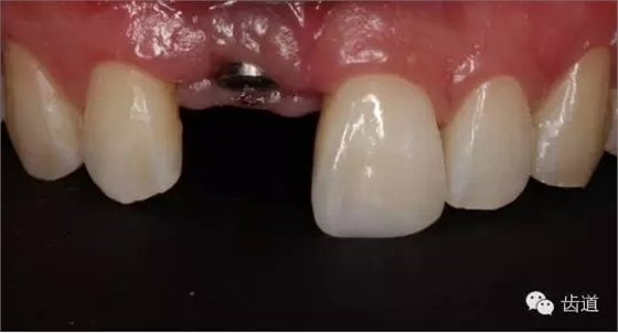 39.webp.jpg 39.webp.jpg