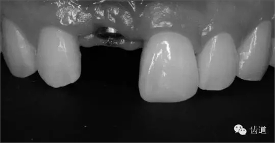 40.webp.jpg 40.webp.jpg