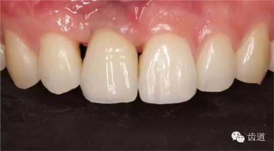 44.webp.jpg 44.webp.jpg