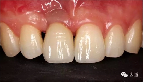 47.webp.jpg 47.webp.jpg