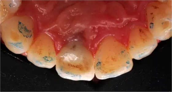 49.webp.jpg 49.webp.jpg