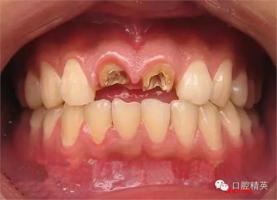 2.webp.jpg 2.webp.jpg