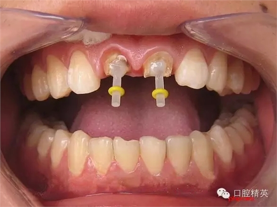 3.webp.jpg 3.webp.jpg