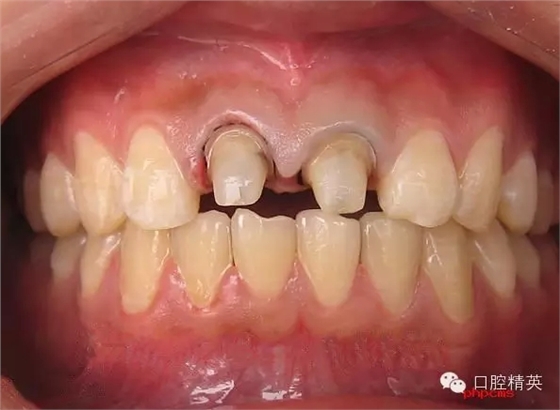 5.webp.jpg 5.webp.jpg