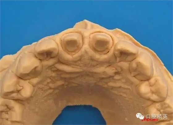 6.webp.jpg 6.webp.jpg