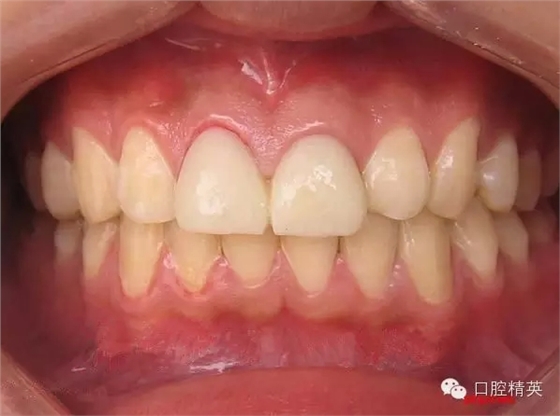 7.webp.jpg 7.webp.jpg