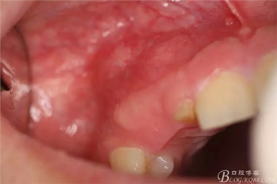 1.webp.jpg 1.webp.jpg