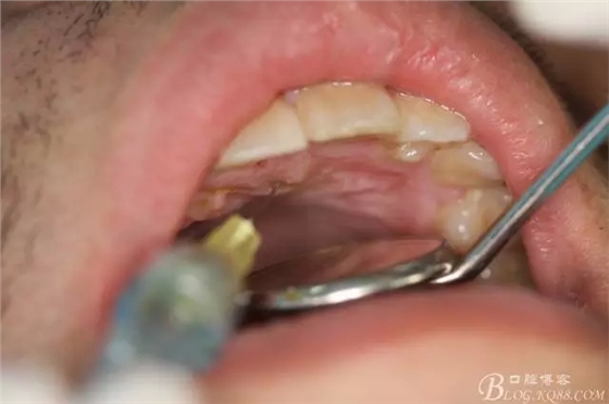 3.webp.jpg 3.webp.jpg