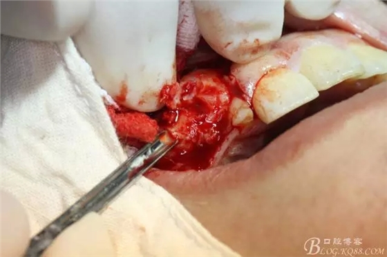 6.webp.jpg 6.webp.jpg