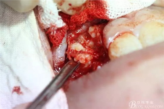 10.webp.jpg 10.webp.jpg