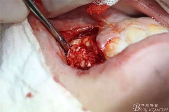 11.webp.jpg 11.webp.jpg