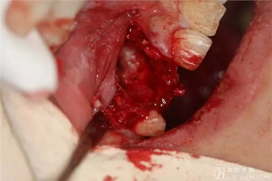 14.webp.jpg 14.webp.jpg