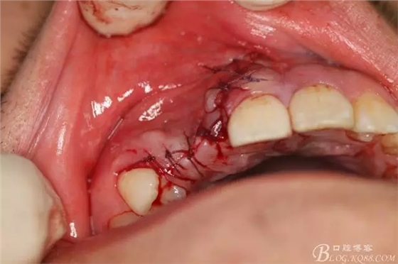 17.webp.jpg 17.webp.jpg