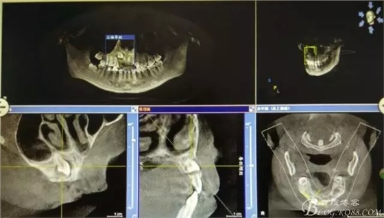 2.webp.jpg 2.webp.jpg