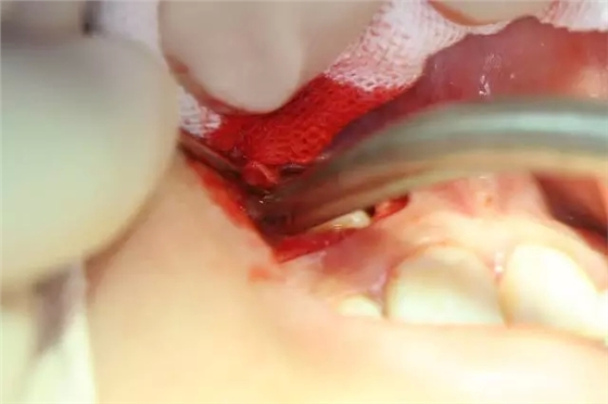 6.webp.jpg 6.webp.jpg