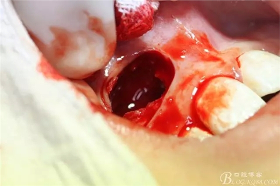 10.webp.jpg 10.webp.jpg