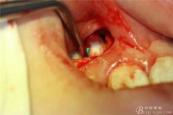 13.webp.jpg 13.webp.jpg