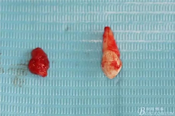 17.webp.jpg 17.webp.jpg