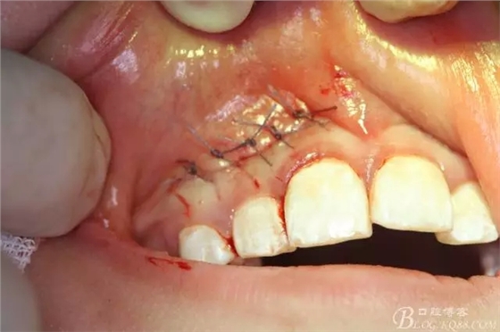 18.webp.jpg 18.webp.jpg