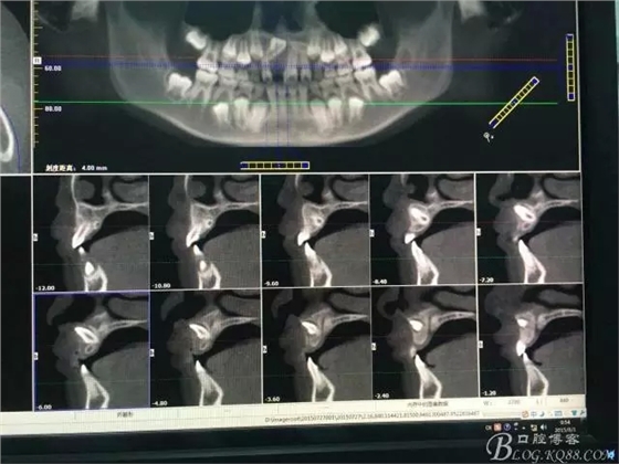 1.webp.jpg 1.webp.jpg