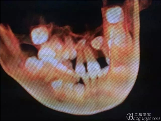 3.webp.jpg 3.webp.jpg