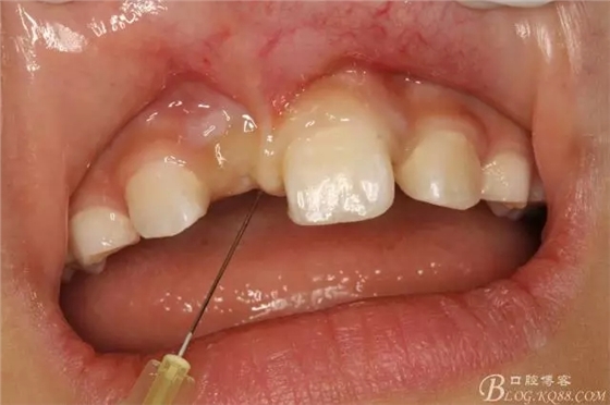 5.webp.jpg 5.webp.jpg