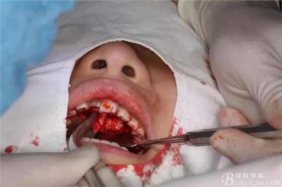 6.webp.jpg 6.webp.jpg