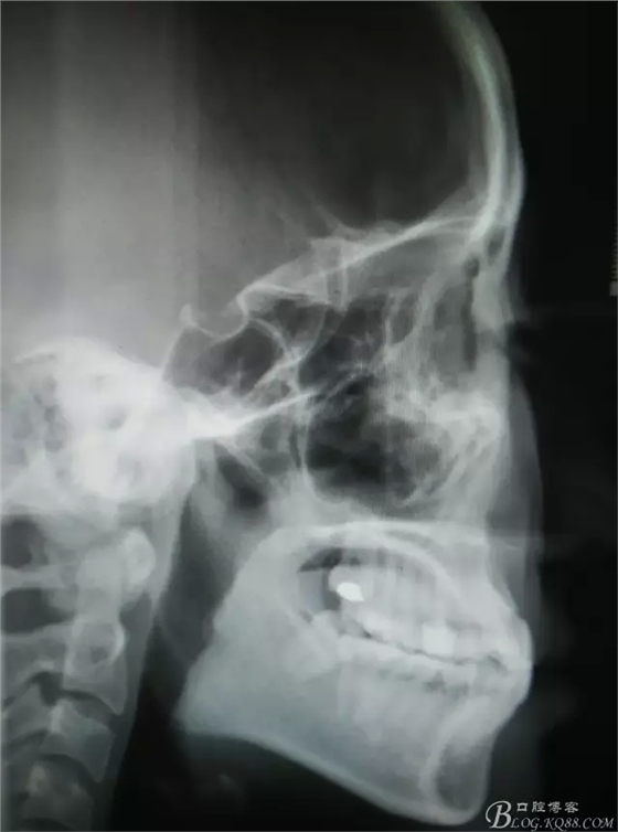 2.webp.jpg 2.webp.jpg