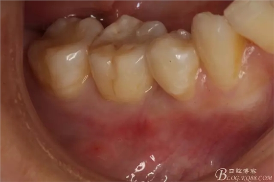 4.webp.jpg 4.webp.jpg