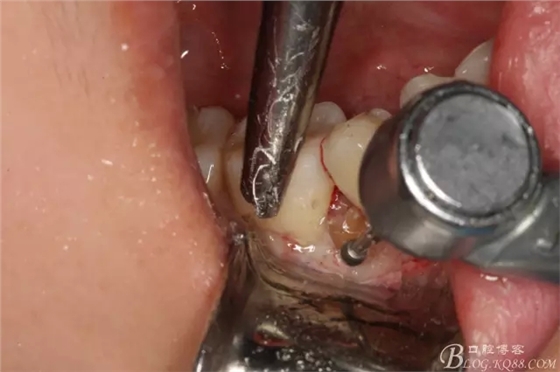 9.webp.jpg 9.webp.jpg