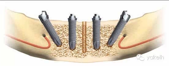 2.webp.jpg 2.webp.jpg