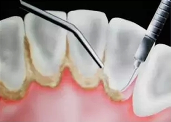 31.webp.jpg 31.webp.jpg