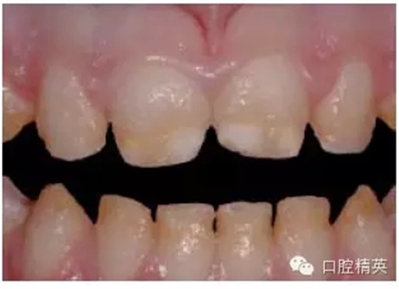 6.webp.jpg 6.webp.jpg