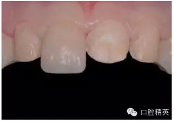 10.webp.jpg 10.webp.jpg