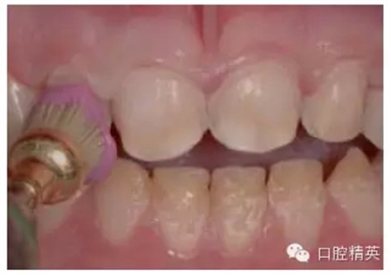 11.webp.jpg 11.webp.jpg