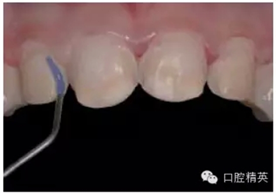 17.webp.jpg 17.webp.jpg