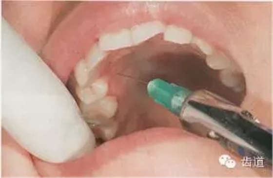 1.webp.jpg 1.webp.jpg