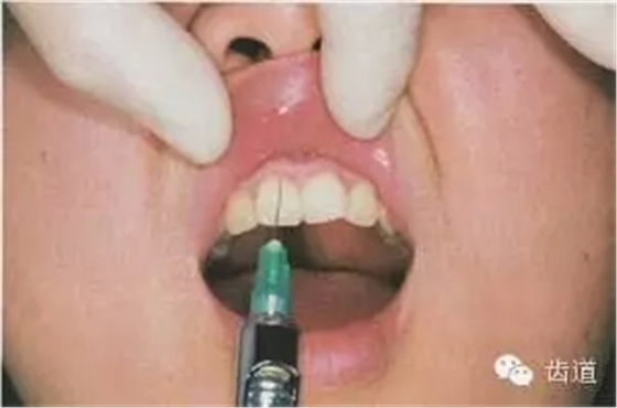 2.webp.jpg 2.webp.jpg