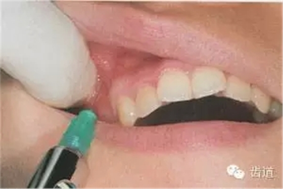 4.webp.jpg 4.webp.jpg