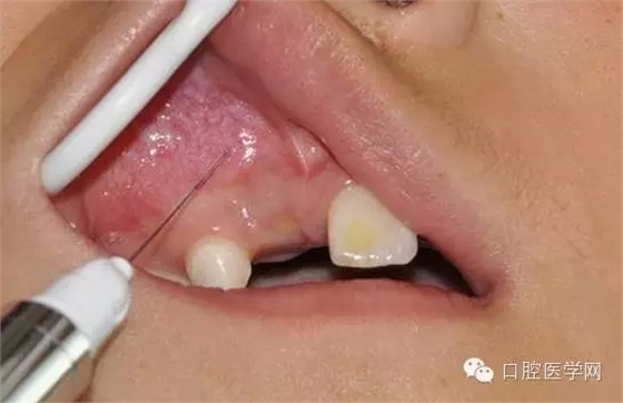 25.webp.jpg 25.webp.jpg