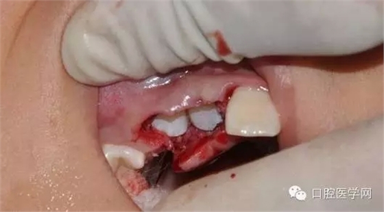 28.webp.jpg 28.webp.jpg