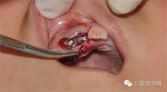 30.webp.jpg 30.webp.jpg